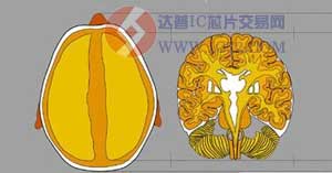 东芝Aquilion ONE，专为儿童设计的CT系统